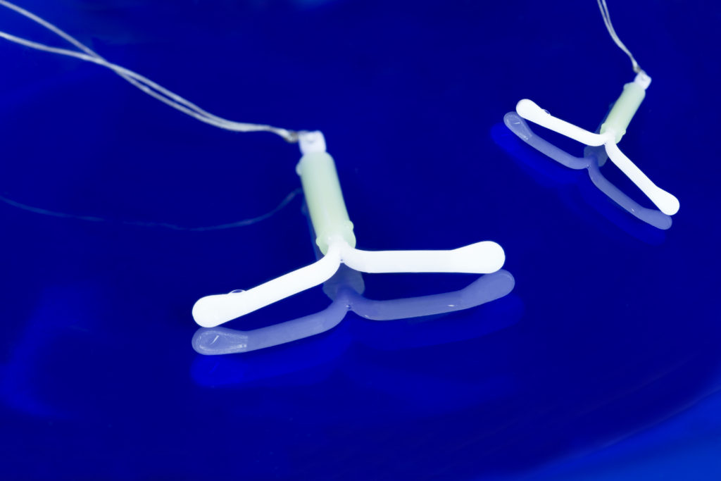 iud side effects