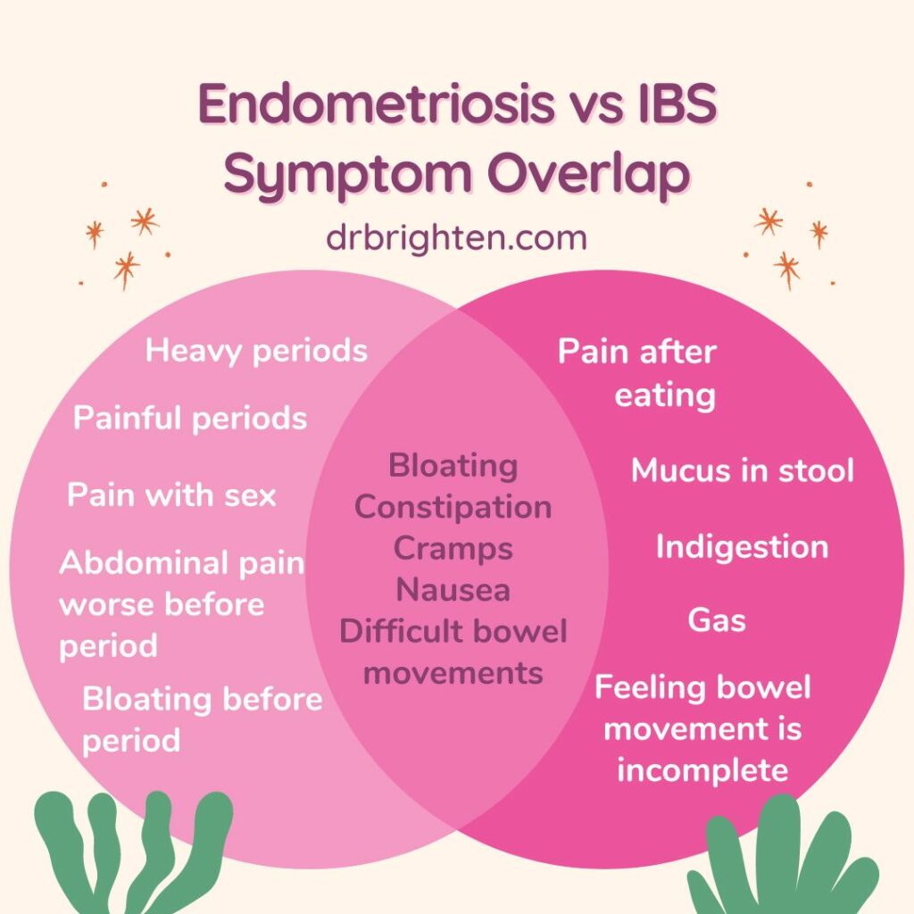 Endometriosis vs IBS