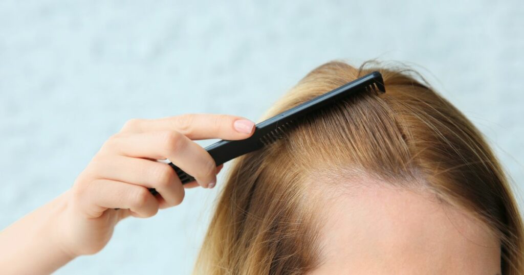 thinning hair menopause
