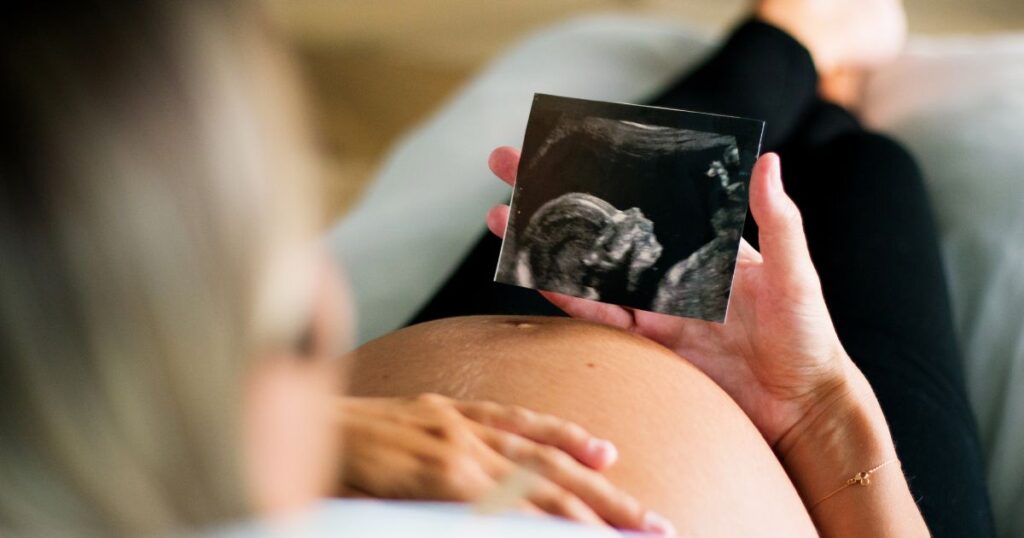 iodine for pregnant women