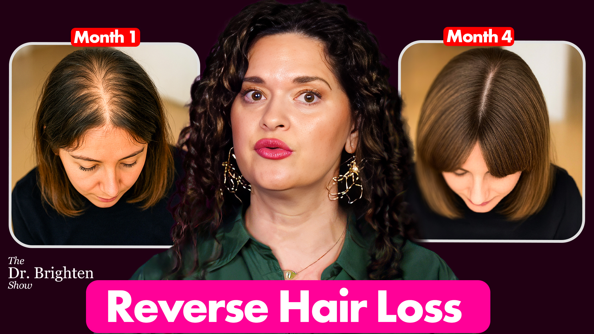 female hair loss treatment Dr. Brighten